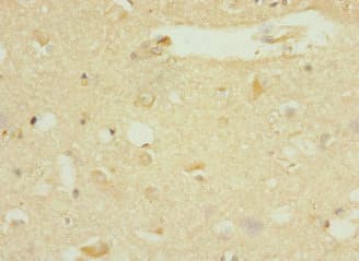 Polyclonal Rabbit anti-Human DNAJB2 Antibody (IHC, WB)