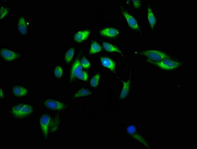 IHC-plus™ CALR / Calreticulin Antibody (aa 18-417)