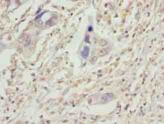 VPS25 Antibody