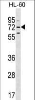 Polyclonal Rabbit anti-Human MBTD1 Antibody (aa564-592, IHC, WB)