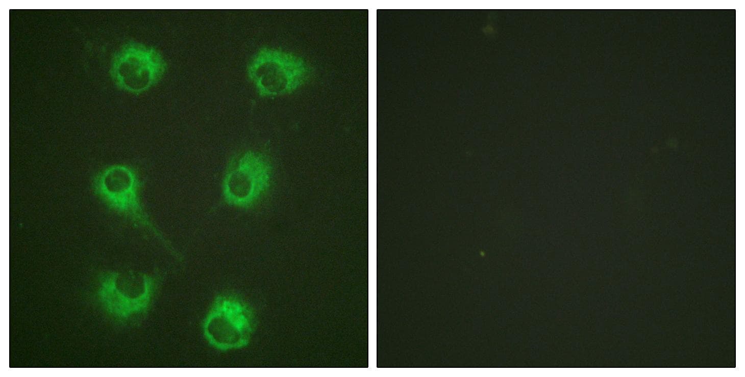 CRKL Antibody (p207)