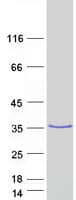 Human HSD17B3 Protein (Recombinant Myc-DDK (Flag))