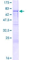 Human SYNCRIP / HnRNP Q Protein (Recombinant GST)