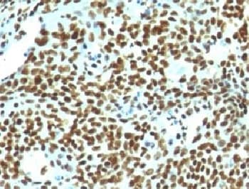 Nuclear Antigen Antibody (clone NM106, Ready-to-Use)