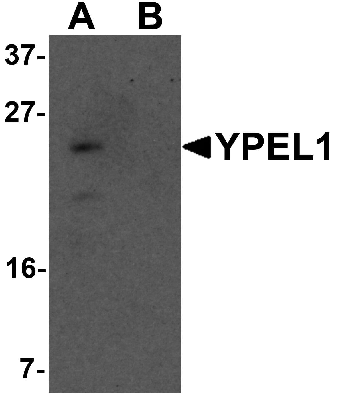 IHC-plus™ YPEL1 Antibody