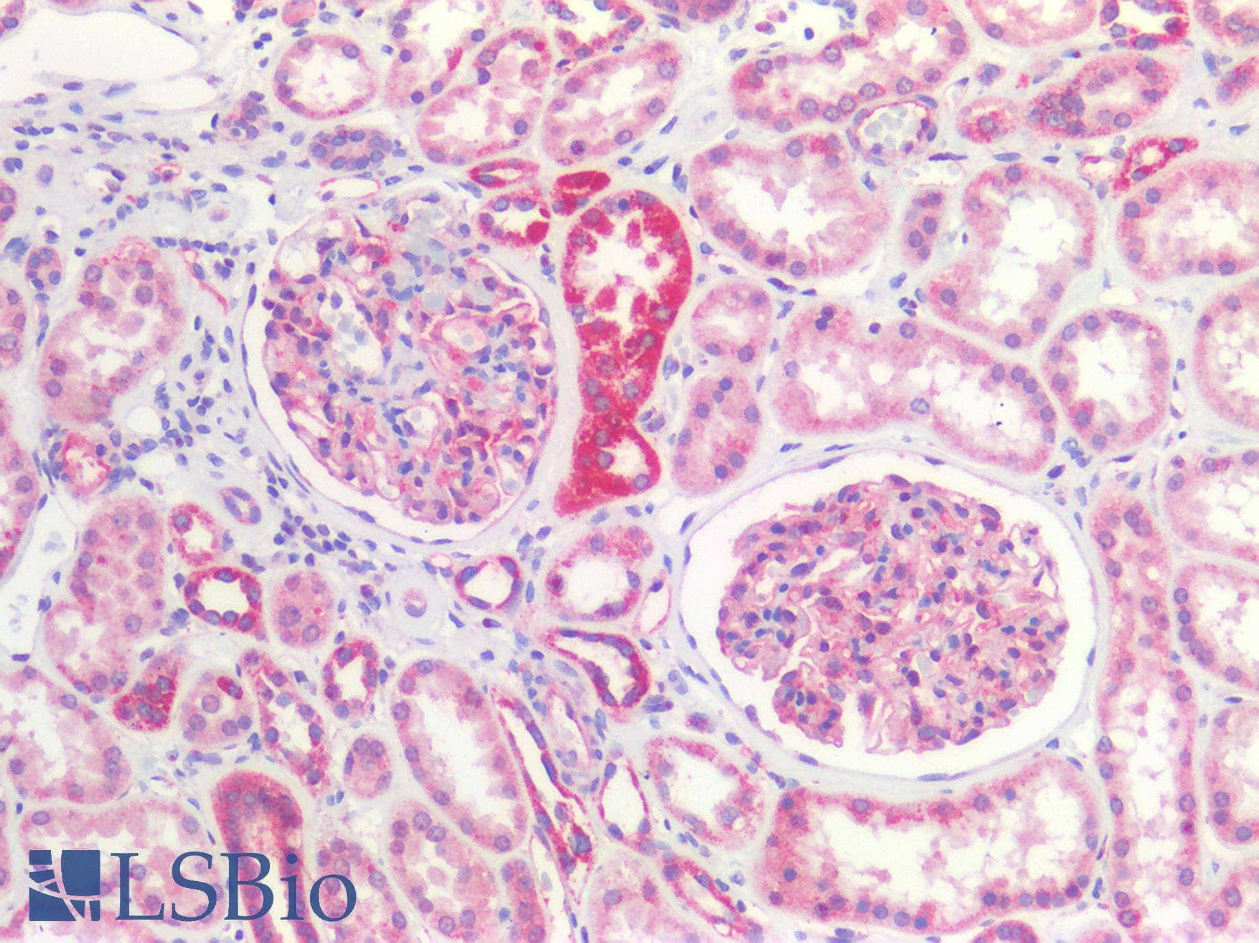 PathPlus™ CLDN5 / Claudin 5 Antibody (C-Terminus)