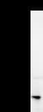 DDB2 Antibody (clone 2246C4a)