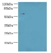 KATNAL2 Antibody