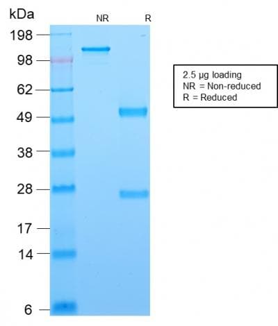 Recombinant Monoclonal Mouse anti-Human BCL6 Antibody (clone rBCL6/1718, Azide-free,Carrier-free, aa256-389, IHC)