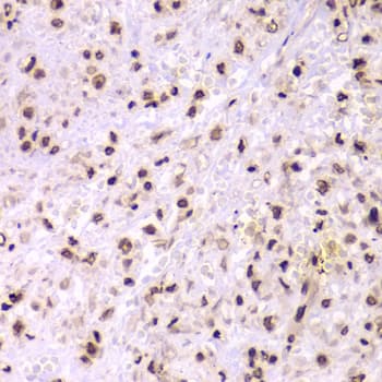 XRCC6 / Ku70 Antibody