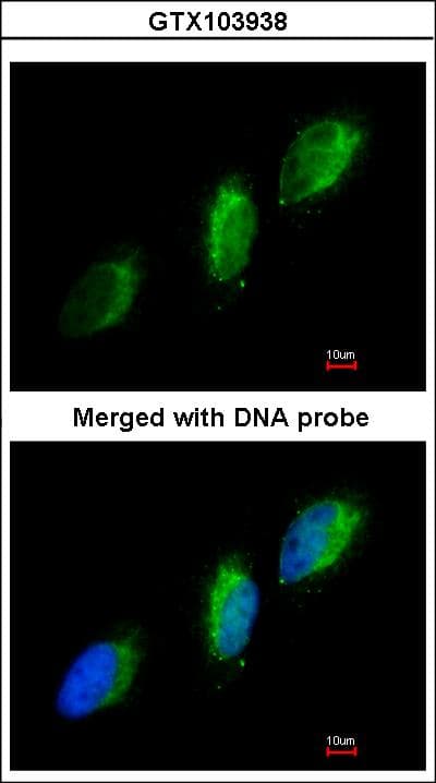 TYK2 Antibody (aa680-1187)