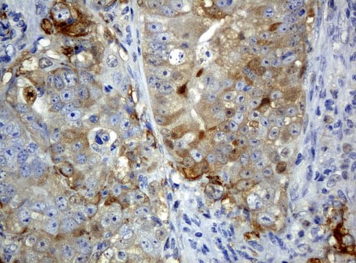 Monoclonal Mouse anti-Human SQSTM1 Antibody (clone UMAB13, IHC, IF, WB)