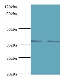 MAP2K3 / MEK3 / MKK3 Antibody (aa1-170)