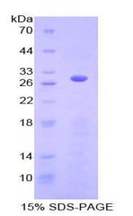 Human ACTC1 / Alpha Cardiac Actin Protein (Recombinant 6His, N-terminus)