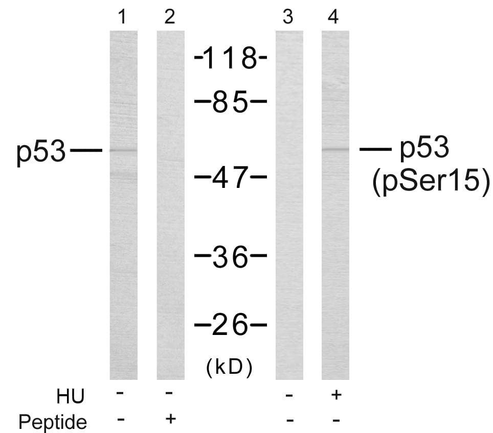 Polyclonal Rabbit anti-Human TP53 / p53 Antibody (phospho-Ser15, IHC, WB)