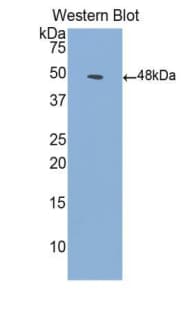 ALK2 / ACVR1 Antibody (aa208-340)