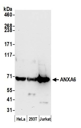 ANXA6/Annexin A6/Annexin VI Antibody (aa500-550)