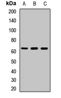 Rhodopsin Kinase / GRK1 Antibody