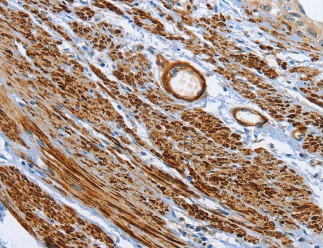 SHROOM2 Antibody