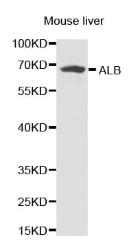 Polyclonal Rabbit anti-Human ALB / Serum Albumin Antibody (IHC, WB)
