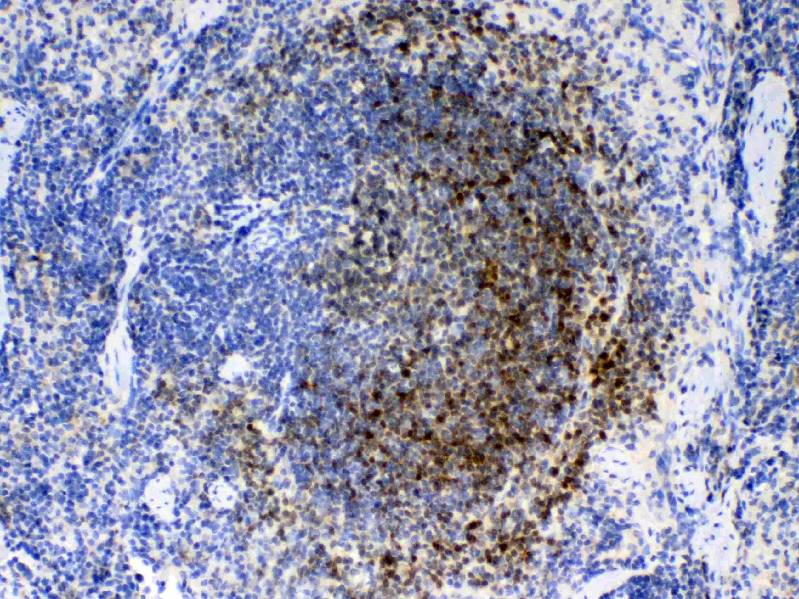BID Antibody