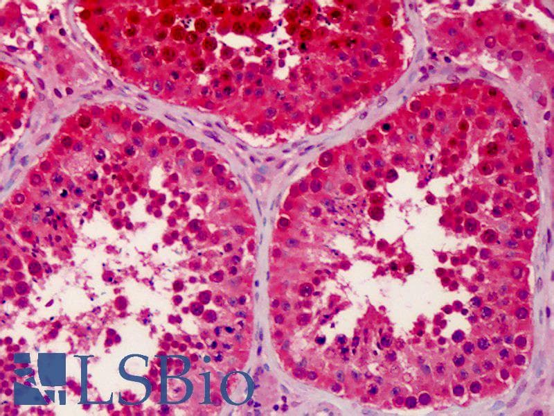 IHC-plus™ Polyclonal Rabbit anti-Human RGPD5 Antibody (IHC, WB)