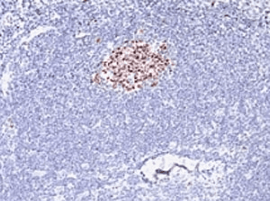BCL6 Antibody (clone SPM602, Azide-free, BSA-free)