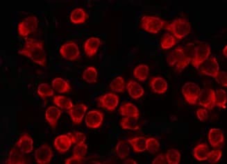 Polyclonal Rabbit anti-Human CLIP1 / CLIP-170 Antibody (IF, WB)