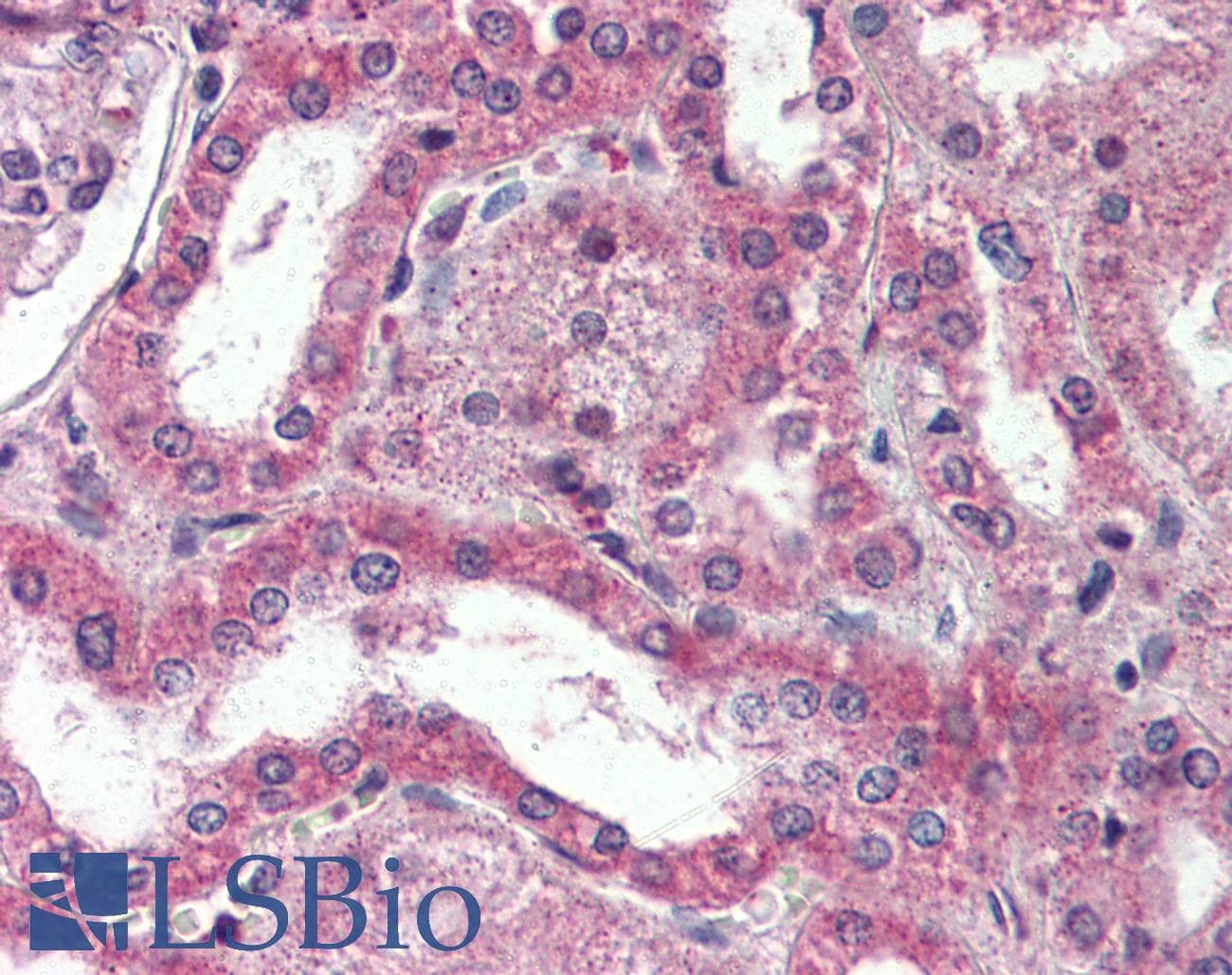 IHC-plus™ Dipeptidylpeptidase 10 / DPP10 Antibody (Internal)