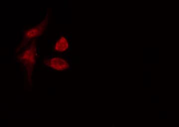 Translokin / CEP57 Antibody