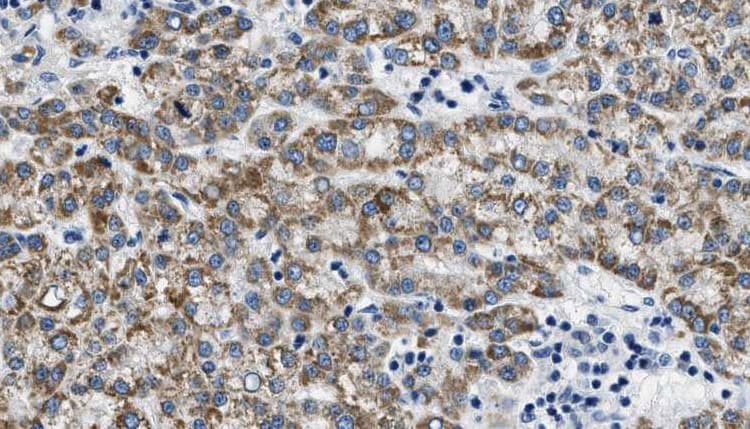 Polyclonal Rabbit anti-Human KCNQ4 Antibody (IHC, IF, WB)