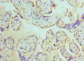 Polyclonal Rabbit anti-Human ATG16L1 / ATG16L Antibody (aa90-300, IHC, WB)