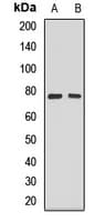Polyclonal Rabbit anti-Human SEPT9 / Septin 9 Antibody (WB)