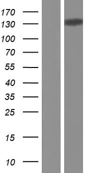 Human CTCF Protein (Over-Expression Lysate Myc-DDK (Flag))