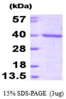 Human FKBP6 Protein (Recombinant His)