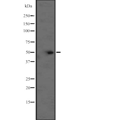 BCL2L13 / Bcl Rambo Antibody