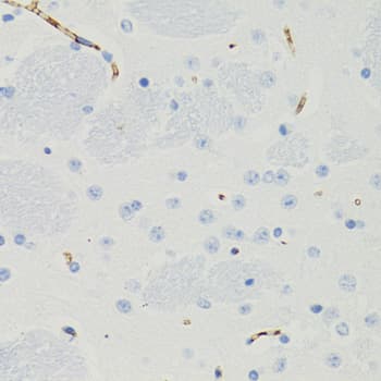 GALT Antibody