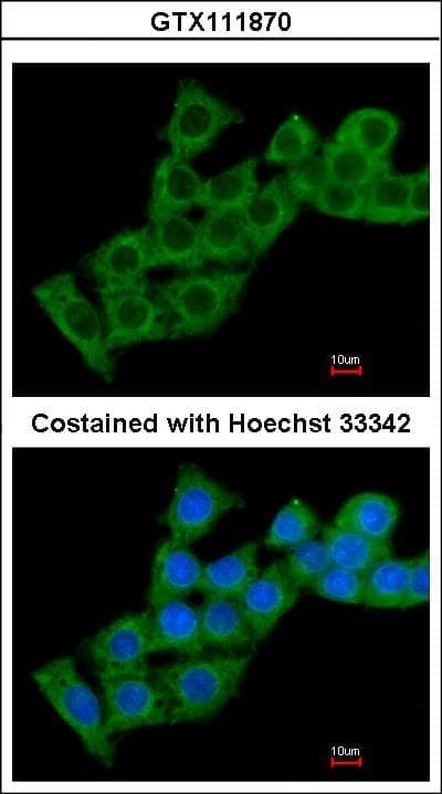 SLC9A1BP / CHP Antibody (aa47-141)