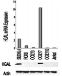 Monoclonal Mouse anti-Human GCET2 / HGAL Antibody (clone 1H1-A7, IHC, WB)