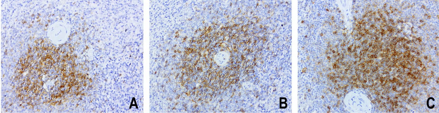 FCER2 / CD23 Antibody (aa48-321, clone UMAB101, Carrier-free)