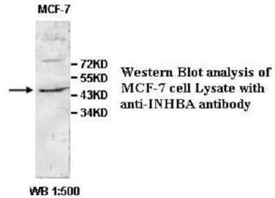 Polyclonal Rabbit anti-Human INHBA / Inhibin Beta A Antibody (aa126-391, IHC, WB)