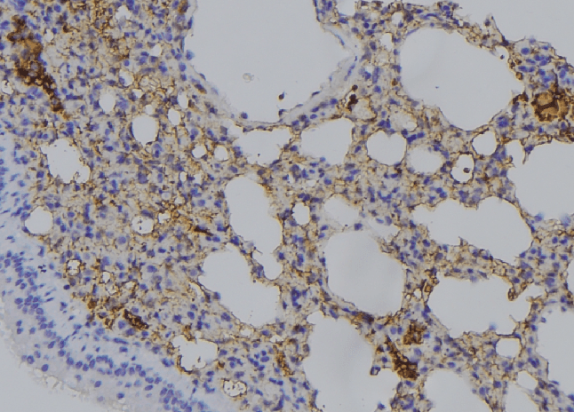 RAB11A Antibody