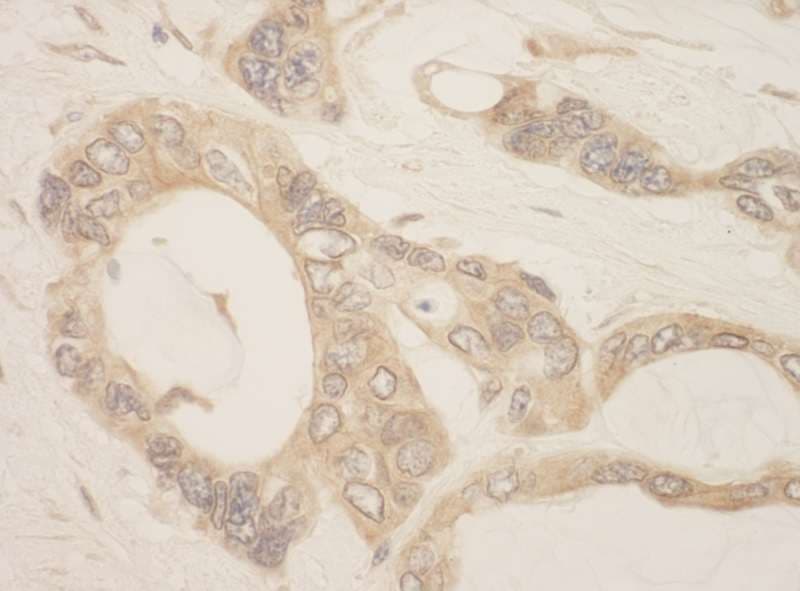 CASC3 / MLN51 Antibody (aa225-275)