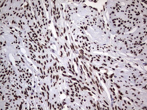 HNRNPL / hnRNP L Antibody (aa270-502, clone OTI9G7, Carrier-free)