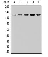 Polyclonal Rabbit anti-Human GLCNE / GNE Antibody (IHC, WB)