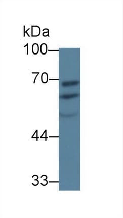 PDIA5 / PDIR Antibody (aa378-506)
