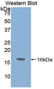 IGF1 Antibody (aa49-153)