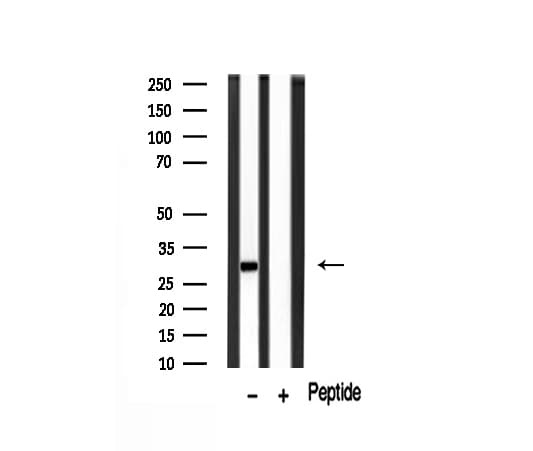 Polyclonal Rabbit anti-Human MMP7 / Matrilysin Antibody (IHC, IF, WB)
