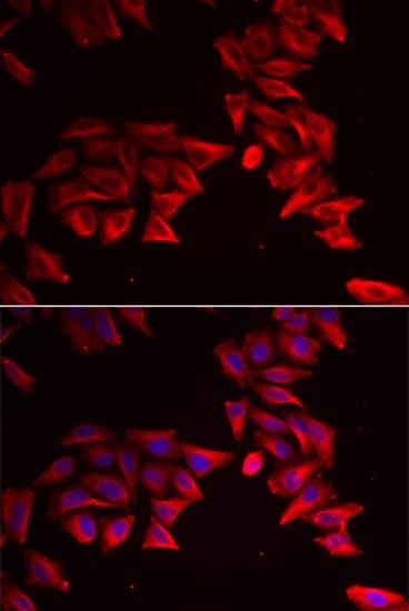 IHC-plus™ SFRP4 Antibody