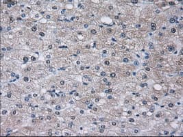 Monoclonal Mouse anti-Human SORD / Sorbitol Dehydrogenase Antibody (clone OTI9E7, IHC, IF, WB)